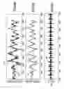 Fig. 08 - Micro movement pulsed radar system and method of phase noise compensation