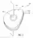Fig. 02 - Eyeglass manufacturing method using variable index layer