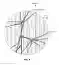 Fig. 05 - Retinal topography diffractive fundus lens