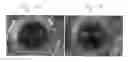 Fig. 03 - Method of determining the spatial relationship of an eye of a person with respect to a camera device