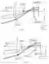 Fig. 06 - High distorted lens