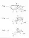 Fig. 03 - Solid electrolytic capacitor and method for manufacturing the same