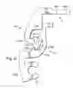 Fig. 18 - Method and apparatus for preventing rotation of a lighting device chassis