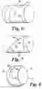 Fig. 05 - X-ray scanning system