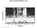 Fig. 05 - Apparatus and method of reducing noise by controlling signal to noise ratio-dependent suppression rate
