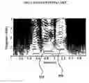 Fig. 06 - Apparatus and method of reducing noise by controlling signal to noise ratio-dependent suppression rate