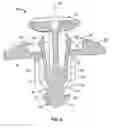 Fig. 05 - Fastener assembly