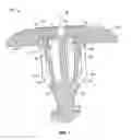 Fig. 06 - Fastener assembly