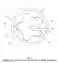 Fig. 03 - Positive displacement motor/progressive cavity pump