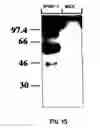 Fig. 20 - Composition and method for modulating vasculogenesis for angiogenesis