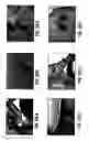 Fig. 30 - Composition and method for modulating vasculogenesis for angiogenesis