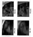 Fig. 34 - Composition and method for modulating vasculogenesis for angiogenesis
