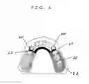 Fig. 07 - Antimicrobial dental materials, restorations, and prostheses