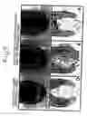 Fig. 05 - Hair tonics and method of screening the same