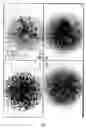 Fig. 04 - Method for detecting the specificity of activated lymphocyte
