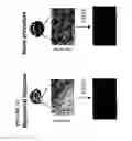 Fig. 02 - Treatment of tumor with dnazyme directed to peroxiredoxin