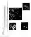 Fig. 38 - Treatment of tumor with dnazyme directed to peroxiredoxin