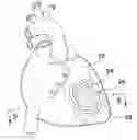 Fig. 01 - Methods and Systems for Treating Injured Cardiac Tissue