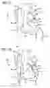 Fig. 08 - Methods and Systems for Treating Injured Cardiac Tissue
