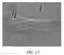 Fig. 12 - Methods and Systems for Treating Injured Cardiac Tissue