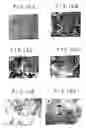 Fig. 22 - Expression of cyclin G1 in tumors