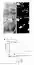 Fig. 23 - Expression of cyclin G1 in tumors