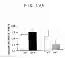 Fig. 27 - Expression of cyclin G1 in tumors