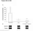 Fig. 17 - Alpha-enolase specific antibody and method of use