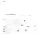 Fig. 06 - Method of quickly measuring factor causing early flocculation of yeast