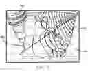 Fig. 06 - Microcapillary networks