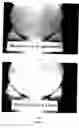 Fig. 14 - Method for making an article water resistant and articles made therefrom