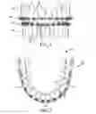 Fig. 02 - HYBRID ORTHODONTIC ARCHWIRE