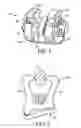 Fig. 04 - HYBRID ORTHODONTIC ARCHWIRE