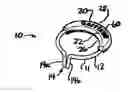 Fig. 01 - Dental implement for tooth restoration