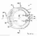 Fig. 05 - Dental implement for tooth restoration
