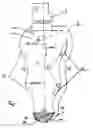 Fig. 02 - Device for Forming Bone Bed for Dental Implant