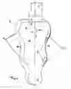Fig. 03 - Device for Forming Bone Bed for Dental Implant
