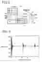 Fig. 03 - Apparatus for determining the preload for dental implant systems