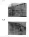 Fig. 07 - Tissue equivalent for transplantation and method for producing same
