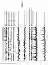 Fig. 09 - Antibodies to HHPEN62 polypeptide