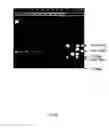 Fig. 06 - Asymmetrical adapters and methods of use thereof