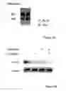 Fig. 04 - MOLECULAR SIGNALING PATHWAYS TRIGGERED BY RITUXIMAB: PROGNOSTIC, DIAGNOSTIC, AND THERAPEUTIC USES