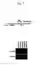 Fig. 09 - Gene expression analysis using array with immobilized tags of more than 25 bp (SuperSAGE-Array)