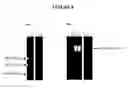 Fig. 07 - Nucleic acid purification with a binding matrix