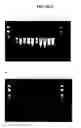 Fig. 10 - Nucleic acid purification with a binding matrix