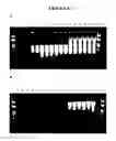 Fig. 15 - Nucleic acid purification with a binding matrix