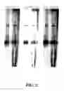Fig. 03 - Enzymatic nucleic acid synthesis: methods for direct detection of tagged monomers