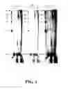 Fig. 04 - Enzymatic nucleic acid synthesis: methods for inhibiting pyrophosphorolysis during sequencing synthesis