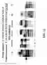 Fig. 13 - Enzymatic nucleic acid synthesis: methods for inhibiting pyrophosphorolysis during sequencing synthesis