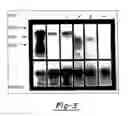 Fig. 04 - Method for diagnosing selected adenocarcinomas